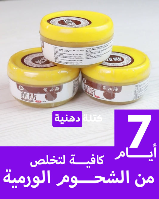 Lipoma 2